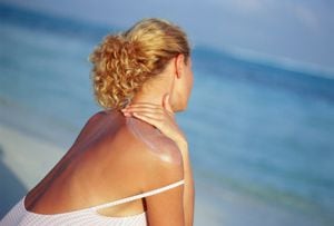 Congelar el bloqueador solar podría causar problemas en la piel.