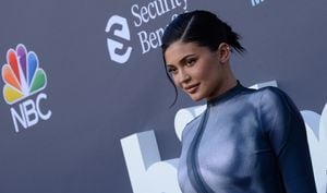 Kylie Jenner es una de las celebridades que luce esta microtendencia.