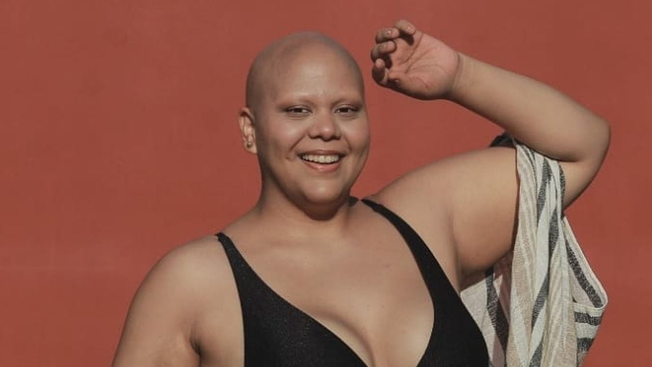 Ana Ramírez, modelos ‘plus size’ con alopecia y activista contra la violencia estética