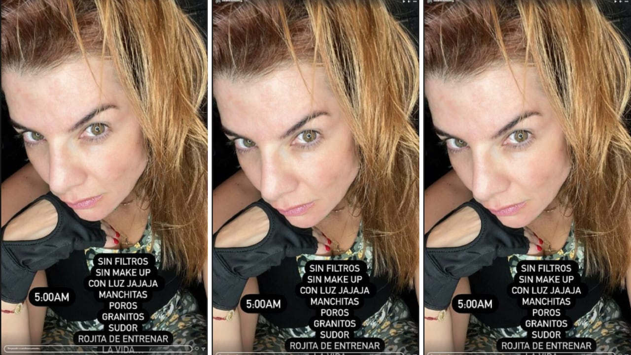 Carolina Cruz posó sin filtros y mostró cómo es su rostro real: “manchitas, granitos, sudor”