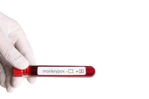 Viruela del mono - Foto de referencia