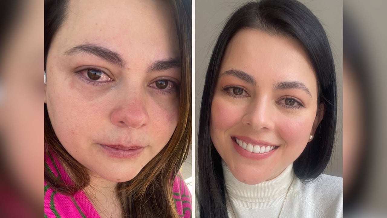 La actriz Paola Moreno confesó que se cosió la lengua para no comer; buscaba el cuerpo perfecto