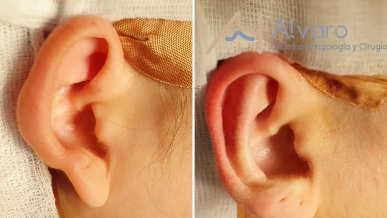 Cirugía Daniela Legarda, captura de pantalla @drhincapiealvaro