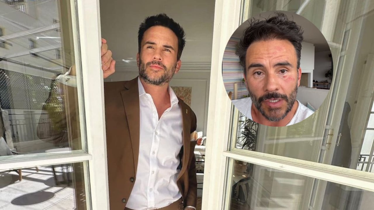 Con la cara golpeada, Juan Pablo Raba denuncia que fue víctima de robo en los cerros de Bogotá junto a sus hijos