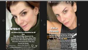 Carolina Cruz habla de las consecuencias en su rostro por su trabajo
Instagram @carolinacruzosorio