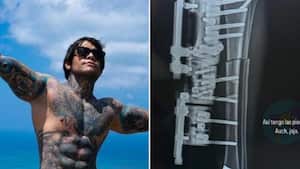 Yeferson Cossio reveló que se mandó a realizar un procedimiento para alargar sus piernas.