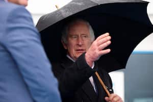 La hinchazón puede obedecer a varias enfermedades, pero no hay diagnóstico oficial, todo es materia de especulación.