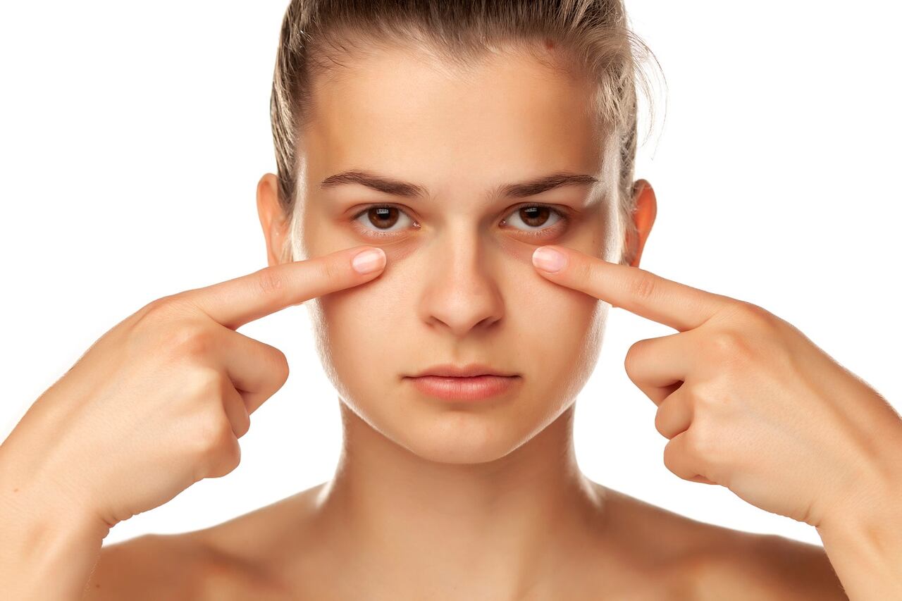 ojeras