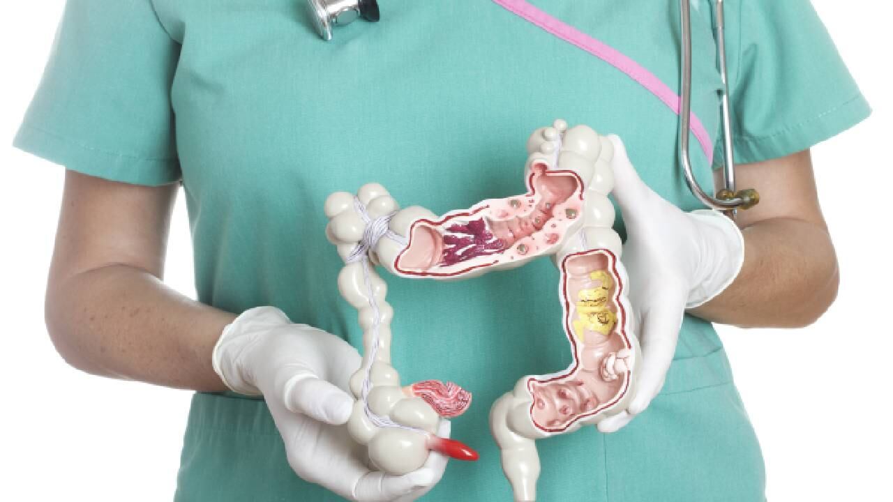El Instituto de Cancerología de Las Américas recomienda comer ensalada en el almuerzo y la comida, también aconseja ingerir como mínimo 3 frutas al día para evitar el colon irritable. Foto: Getty images.