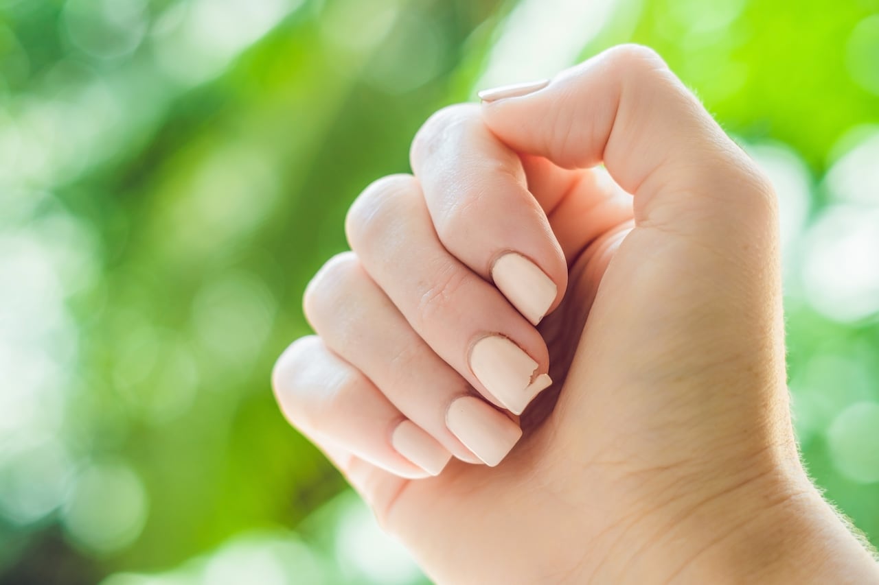 Uñas quebradizas