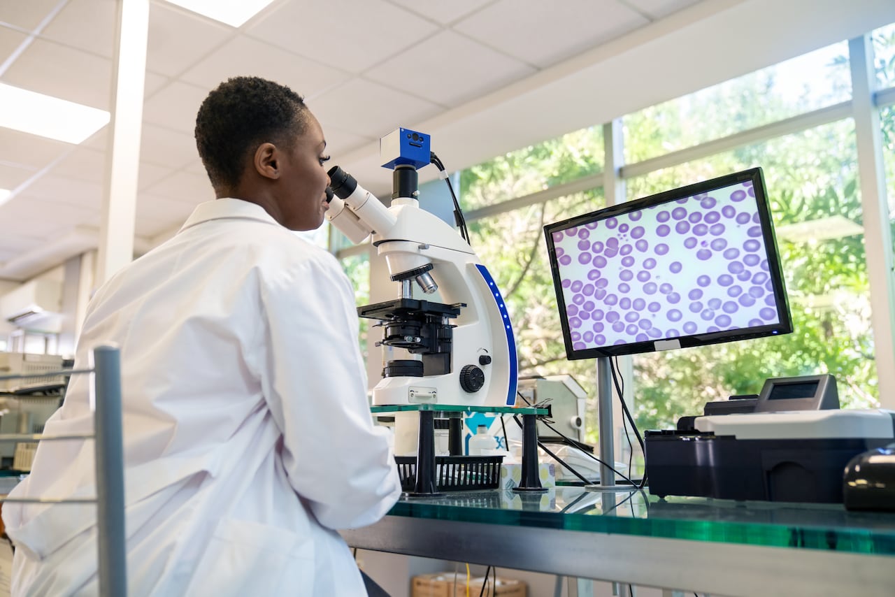 Las células CAR T se reprograman y se concentran en atacar específicamente el tumor.