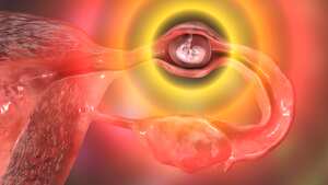 Tubal ectopic pregnancy, 3D illustration showing a 7-week human embryo implanted in the fallopian tube instead of uterus