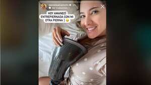 Daniela Álvarez compartió en sus historias de Instagram una foto donde aparece abrazando su prótesis.