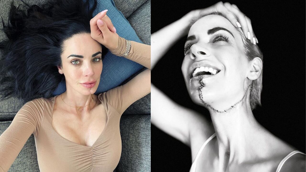 Modelo descubrió que tenía cáncer tras ir al odontólogo: le quitaron la mitad de la lengua