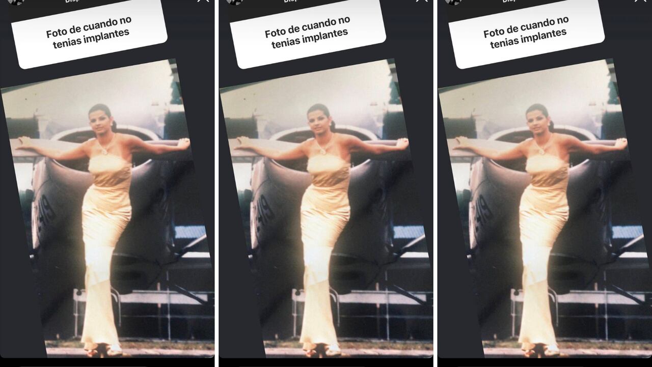 Carolina Cruz sorprende a sus seguidores al mostrar cómo era antes de su operación estética