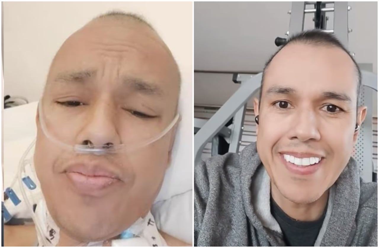 Tras varios días de su cirugía, Diego Guauque sorprende por su impactante cambio - Fucsia