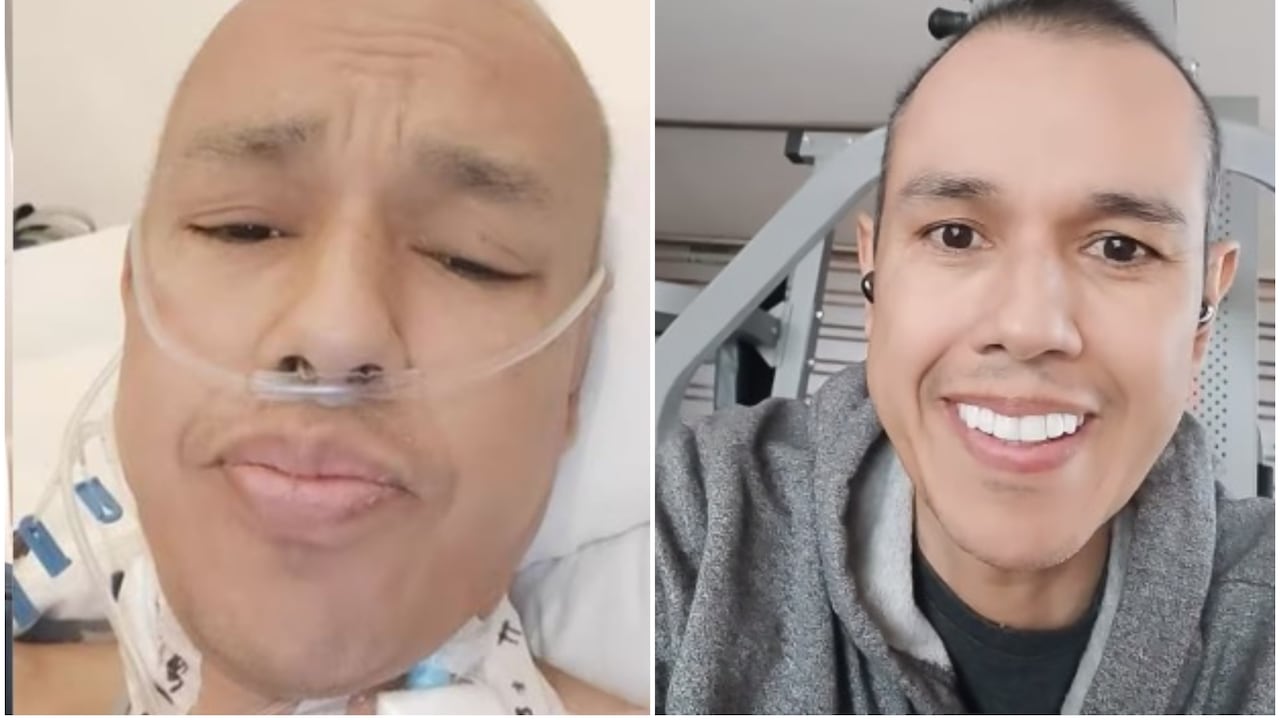 Tras varios días de su cirugía, Diego Guauque sorprende por su impactante cambio - Fucsia